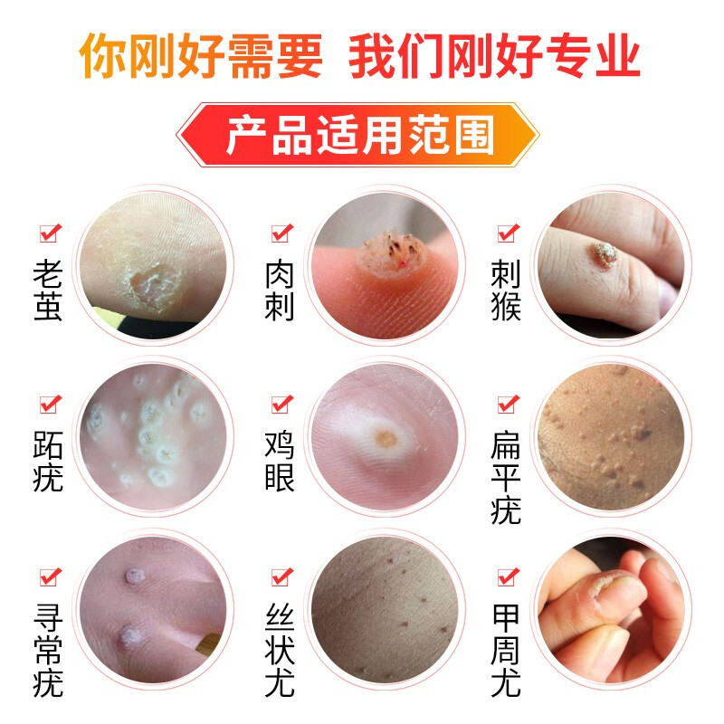 一贴妥 鸡眼膏 鸡眼贴  Ji yan Tie / Yat Tip Tor Corn & Callus Removing Plaster - 12 Plasters - Image 4
