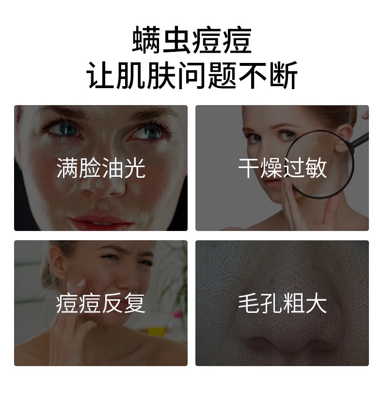 蕲艾 精油皂 Qi Ai Jing You Zao Wormwood Moxibustion Moxa Artemisia Soap 85g - Image 5