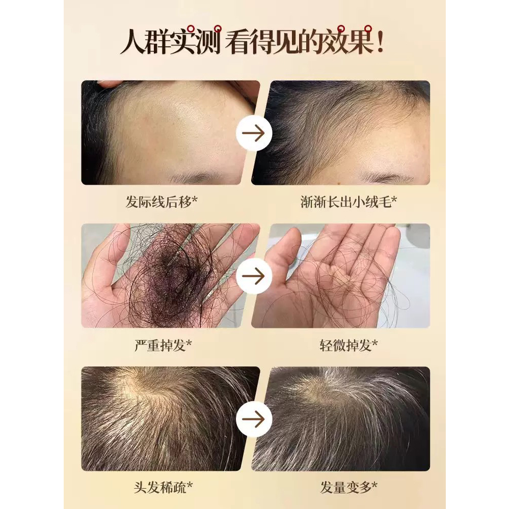 侧柏叶草本养发粉,洗发粉  Premium Chinese Herbs powder for hair  250g - Image 3